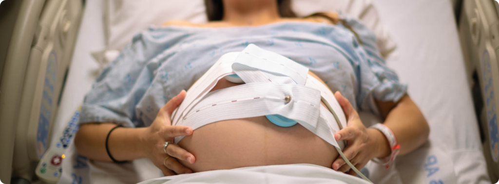 A pregnant woman in a hospital bed wearing a fetal heart rate monitor