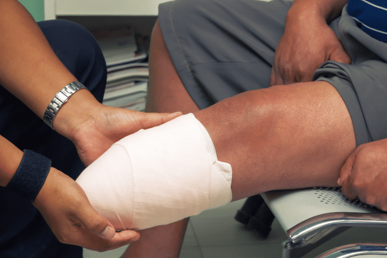 amputation of lower leg